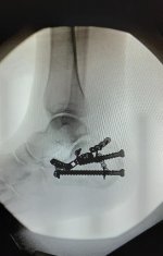 foot 1.jpg
